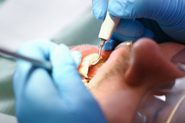 Best Emergency Dental Filling Replacement  in Dripping Springs, TX