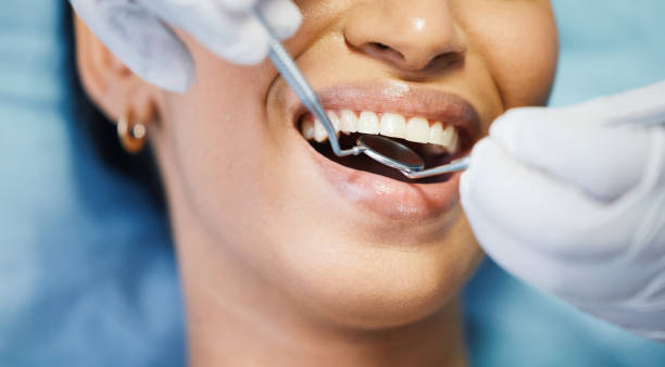 Best Broken Tooth Emergency  in Dripping Springs, TX